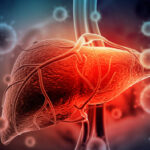 know about Viral Hepatitis Gastro specialist